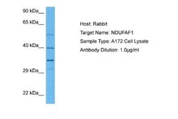 NDUFAF1 Rabbit anti-Human, Polyclonal, Novus Biologicals 0.1ml; Unconjugated:Antibodies,